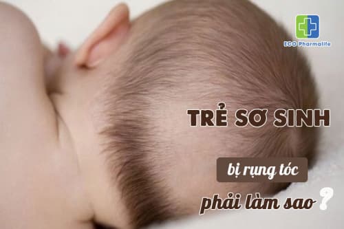 8 nguyên nhân trẻ sơ sinh bị rụng tóc và cách khắc phục