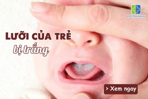 Vì sao lưỡi trẻ sơ sinh bị trắng và cách chữa hiệu quả