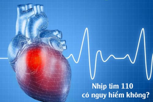 Chuyên gia giải đáp: Nhịp tim 110 có nguy hiểm không?
